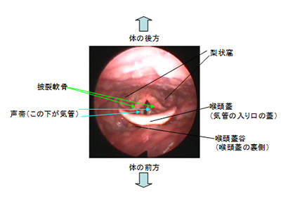 喉頭を上からみた画像