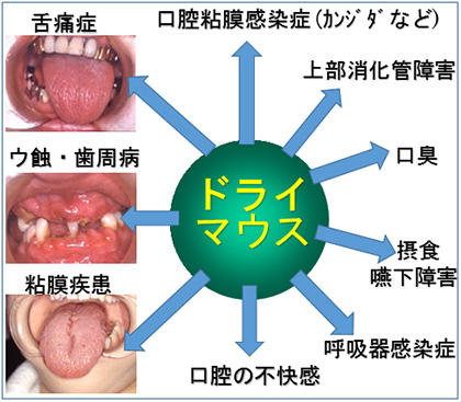 マウス 病院 ドライ