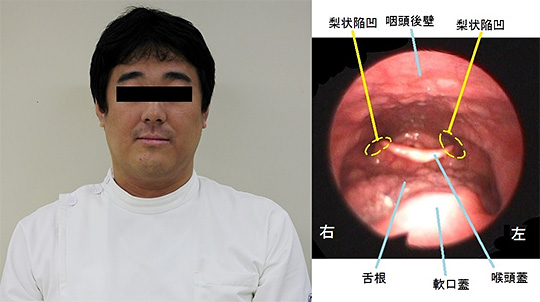直立姿勢