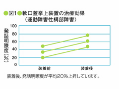 軟口蓋挙上装置の治療効果