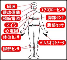 ポリソムノグラフィー装着の状態